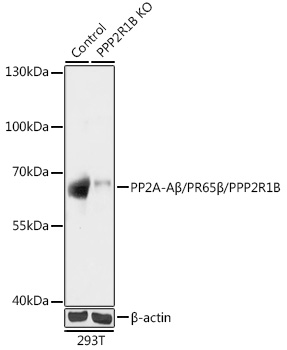 [KO Validated] PP2A-Aβ/PR65β/PPP2R1B Rabbit pAb