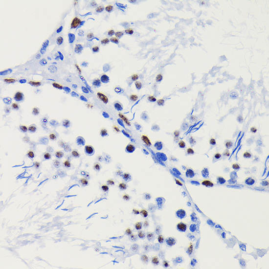[KO Validated] HDAC1 Rabbit mAb