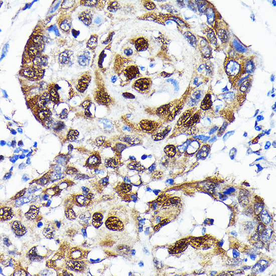 SQSTM1/p62 Rabbit mAb
