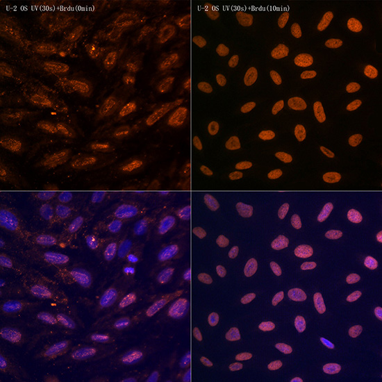 N6-methyladenosine / m6A Rabbit mAb