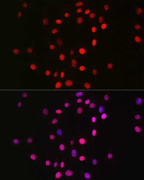 MonoMethyl-Histone H3-K18 Rabbit mAb