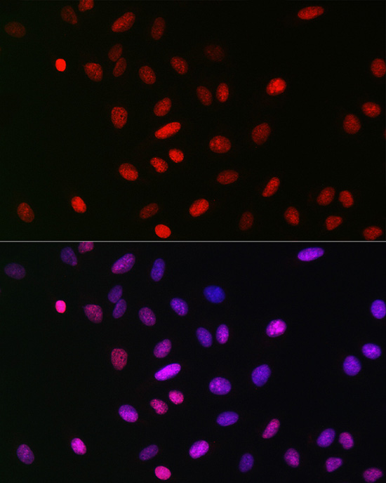 MonoMethyl-Histone H3-K18 Rabbit mAb