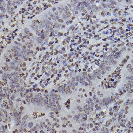 MonoMethyl-Histone H3-K9 Rabbit mAb