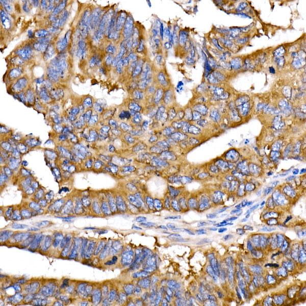 EIF4G2/p97 Rabbit mAb