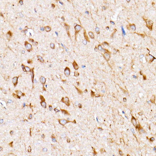 EIF4G2/p97 Rabbit mAb