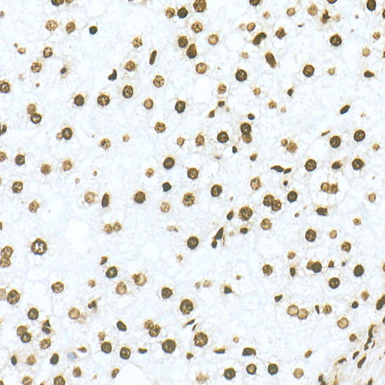 DiMethyl-Histone H3-K79 Rabbit mAb