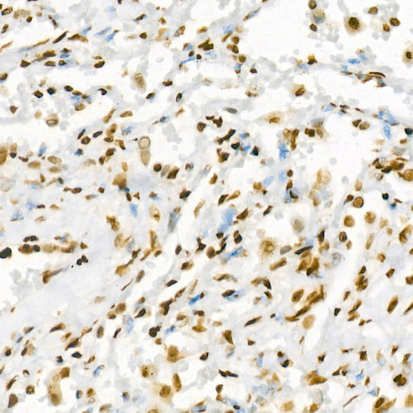 Acetyl-Histone H3-K27 Rabbit mAb