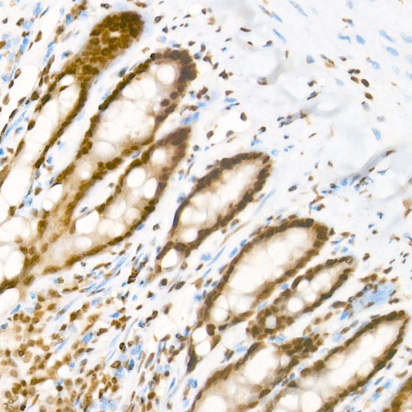 Acetyl-Histone H3-K27 Rabbit mAb