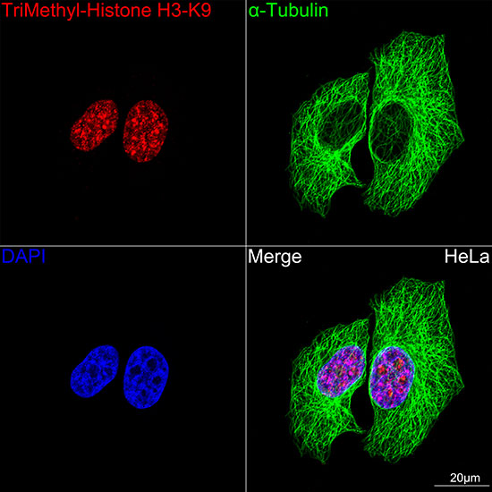 TriMethyl-Histone H3-K9 Rabbit mAb