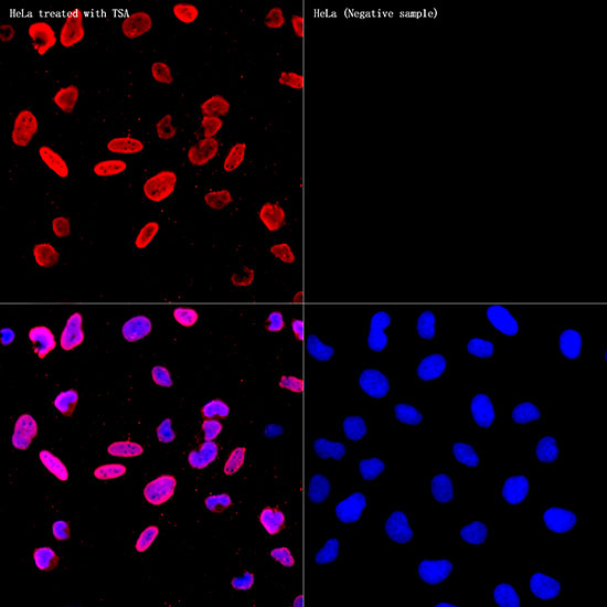 Acetyl-Histone H3-K56 Rabbit mAb