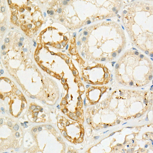 [KO Validated] LKB1 Rabbit mAb