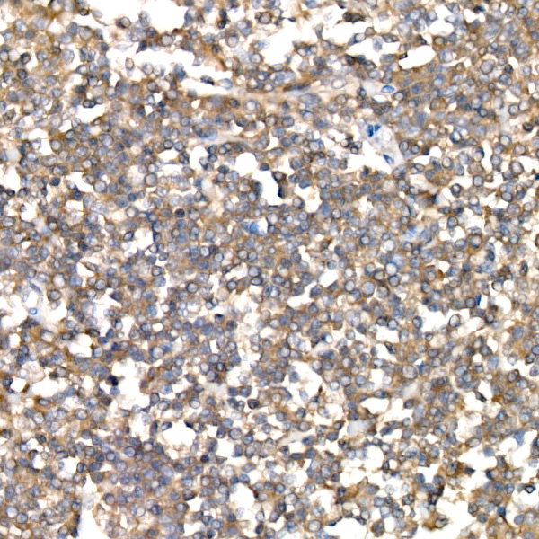 [KO Validated] NF2/Merlin Rabbit mAb