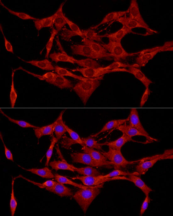 results-for-apc-abclonal