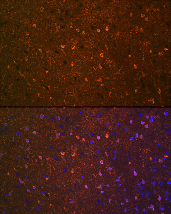 BDNF Rabbit mAb