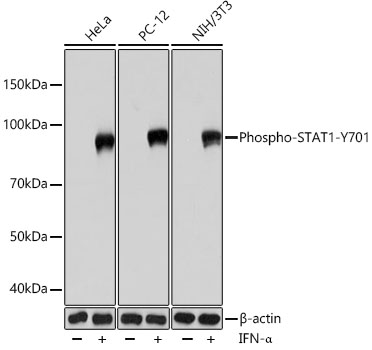 Phospho-STAT1-Y701 Rabbit mAb