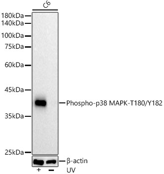Phospho-p38 MAPK-T180/Y182 Rabbit mAb
